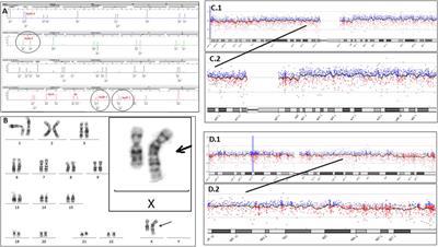 Sometimes karyotype resolves the case!